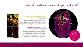 EndoFb-cardio-graphic